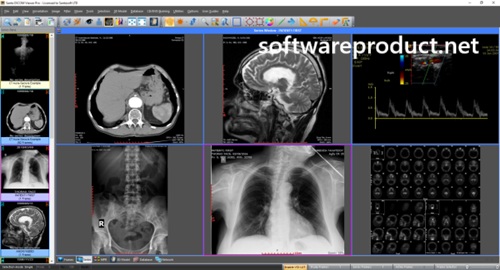 Sante DICOM Viewer